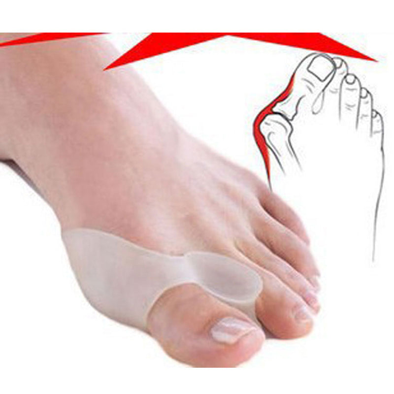 Insole clearance for bunion